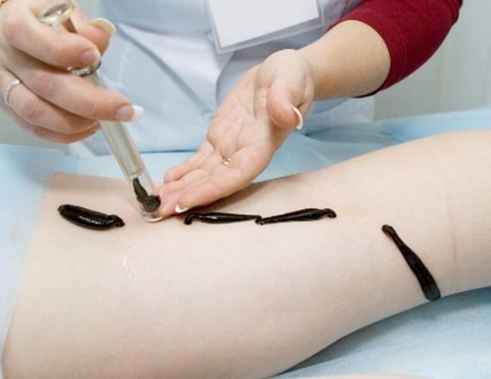 Оздоровительные услуги - Санаторий «Нива» Ессентуки